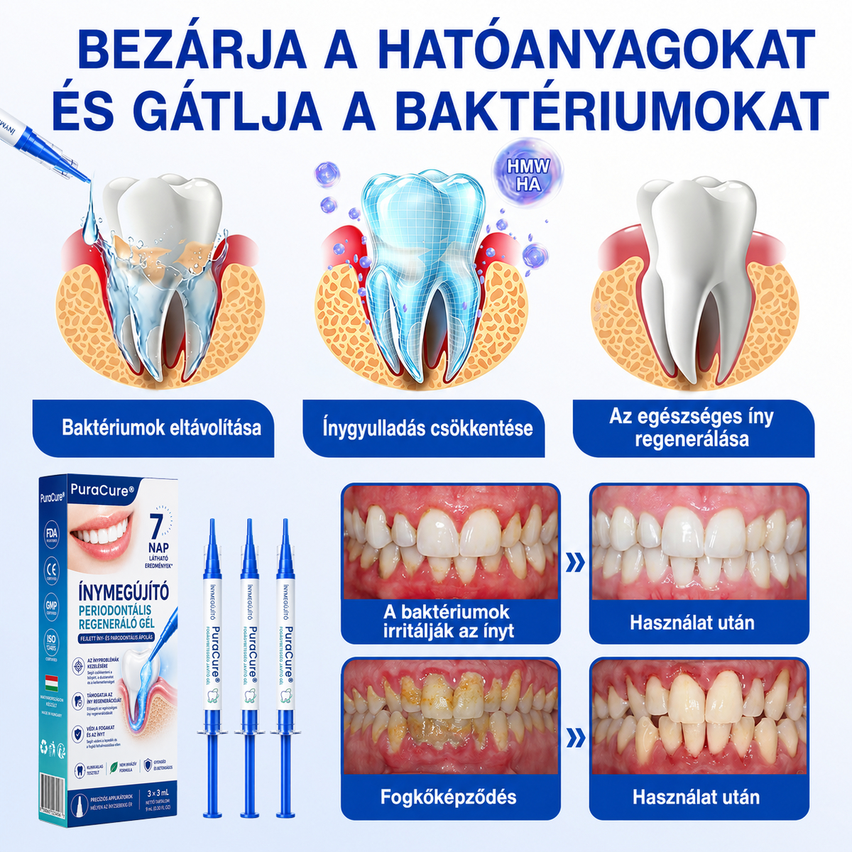 🥇𝑮𝒍𝒊𝒎𝒎𝒆𝒓𝒍𝒚®  ÍNYMEGÚJÍTÓ – Parodontális helyreállító gél