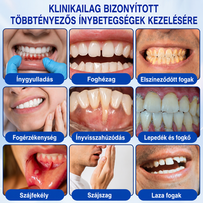 🥇𝑮𝒍𝒊𝒎𝒎𝒆𝒓𝒍𝒚®  ÍNYMEGÚJÍTÓ – Parodontális helyreállító gél